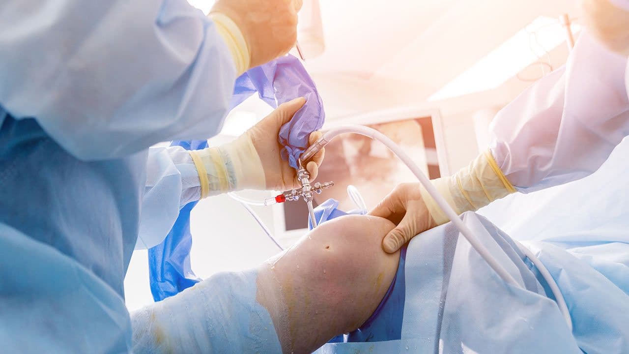 Arthroscopic equipment prepared for knee surgery