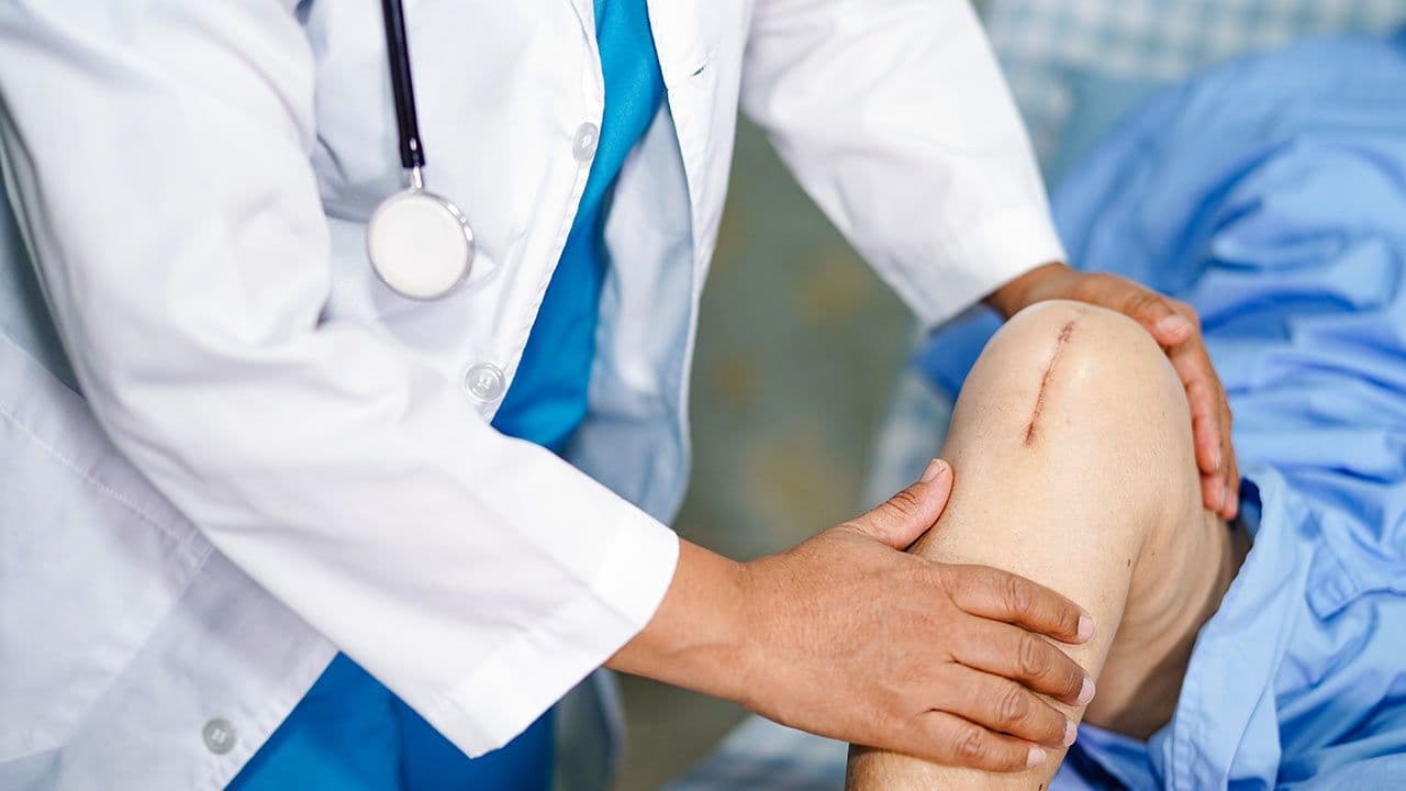 Knee joint replacement care and rehabilitation
